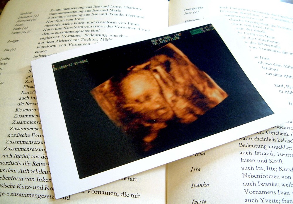 Bild einer Ultraschalluntersuchung / Erwin Wodicka Bild einer Ultraschalluntersuchung eines ungeborenen Kindes bei einer schwangeren Frau, in neuester dreidimensionaler Technik, Foto liegt auf einem Buch mit tausenden Vornamen zum AussuchenSchwangerschaft,Gesundheitswesen,Frauenarzt,Kinder,Neugebor